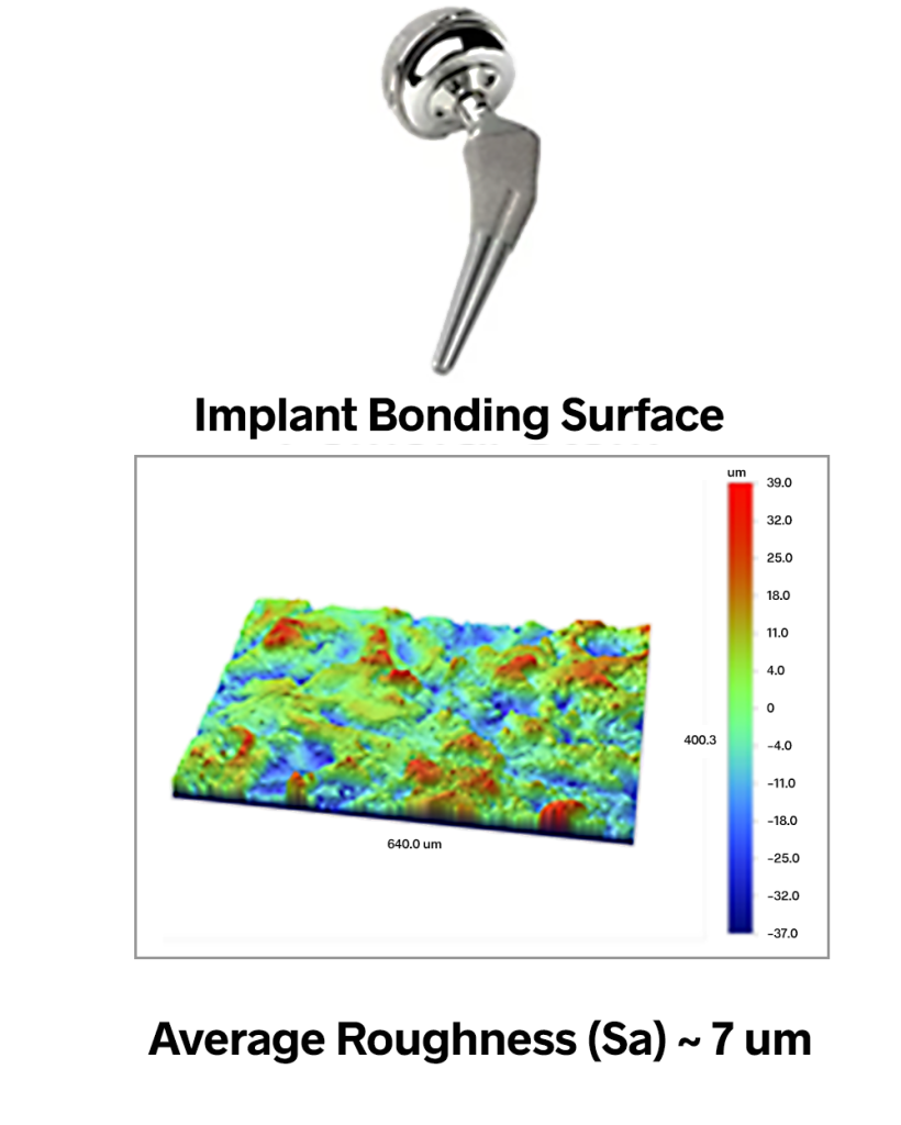 Medical devices surface finish, surface roughness, surface texture for implant, stent, spinal implant, artificial joint - Michigan Metrology